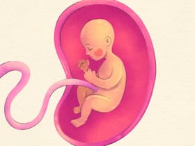 Case Study: How A Baby's Life Was Saved In A Rare Case Of Umbilical Cord Prolapse Case Study: How A Baby's Life Was Saved In A Rare Case Of Umbilical Cord Prolapse