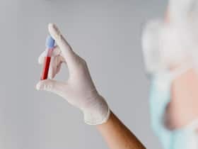 Top 5 Blood Tests You Must Get Done Every Year