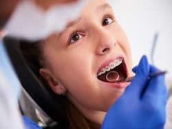 These Are Sure-Shot Signs Your Child May Need Braces