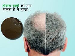 इस 1 नुस्खे से गंजी होती खोपड़ी में उगाएं बाल, 60 की उम्र में भी नहीं झड़ेंगे बाल