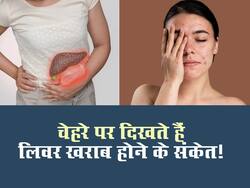 चेहरे पर दिखने वाले इन लक्षणों से समझ जाएं धीरे-धीरे खराब हो रहा है लिवर, समय पर हो जाएं सतर्क