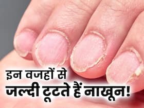 इन बीमारियों की वजह से जल्दी टूटने लग जाते हैं आपके नाखून, समय पर इलाज न कराना पड़ सकता है भारी