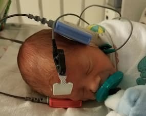 Vital Importance Of Universal Newborn Hearing Screening