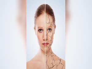 How Pollution Triggers Skin Allergies and What You Can Do About It