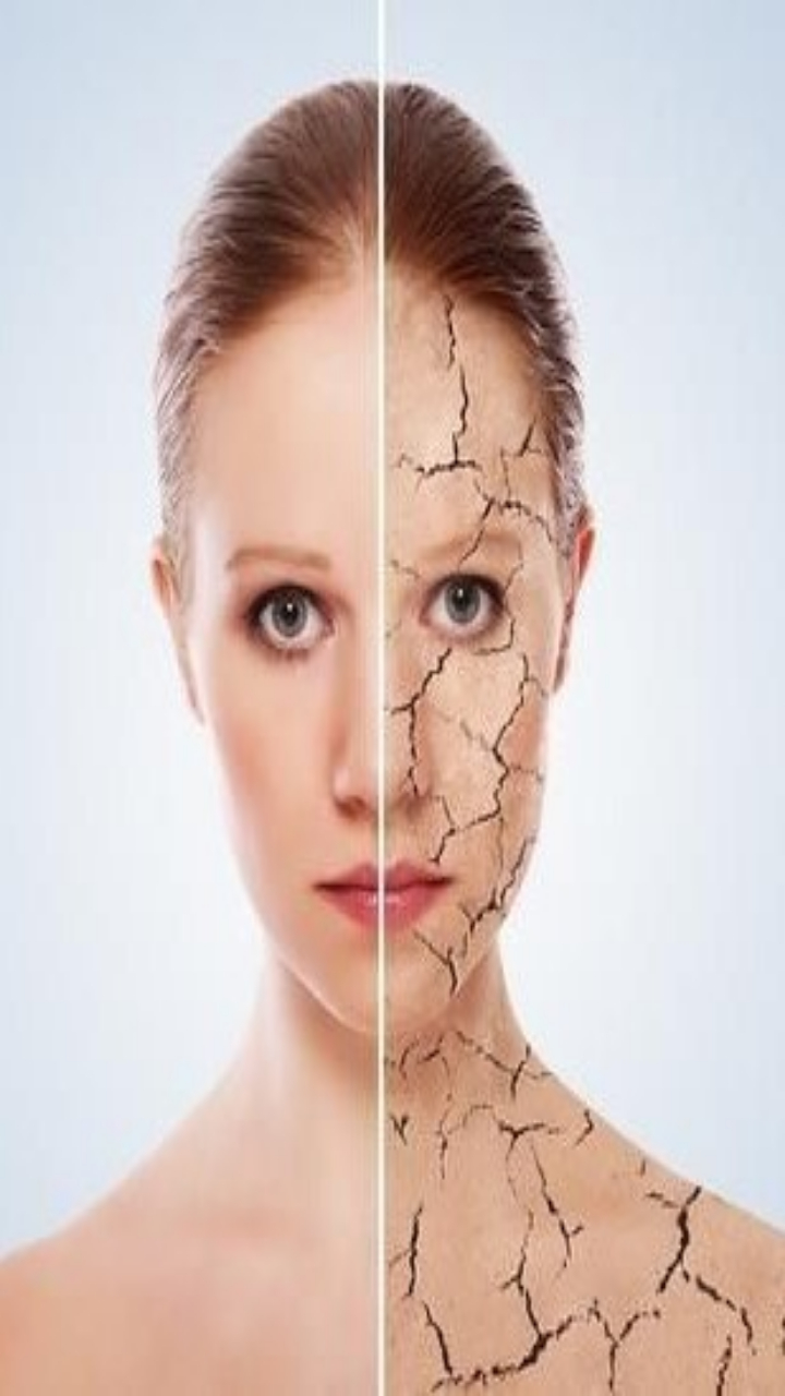 How Pollution Triggers Skin Allergies and What You Can Do About It