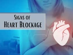 Signs of Heart Blockage: 7 Unexpected Symptoms That Could Indicate Heart Disease