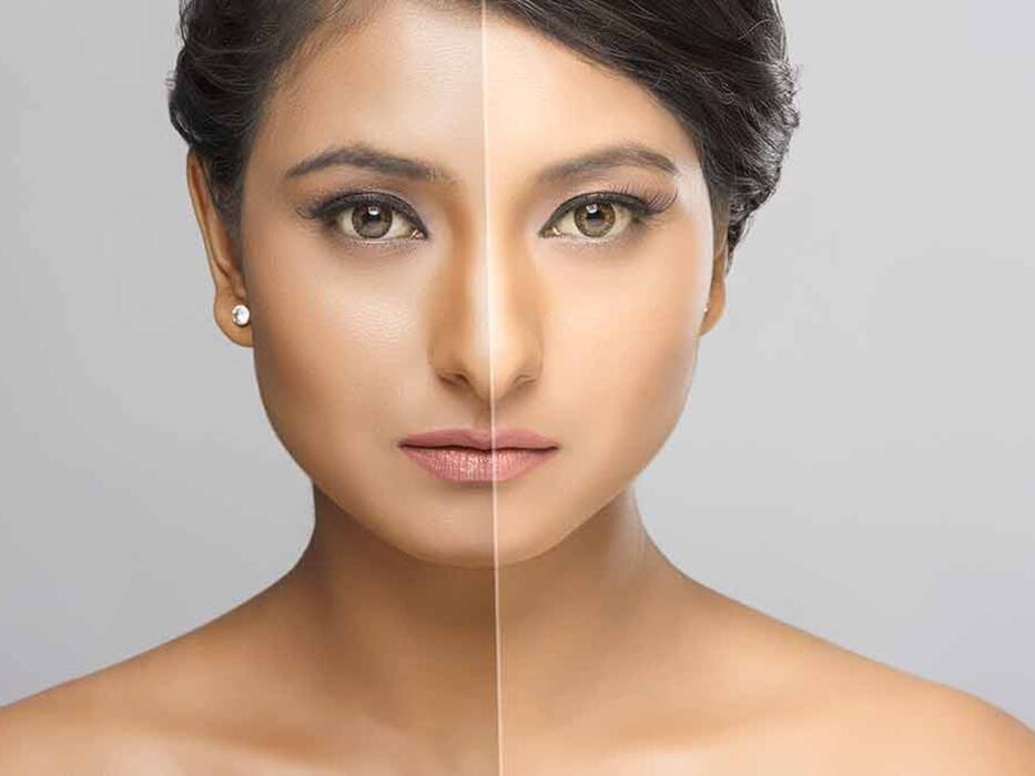 अनार के छिलकों को फेंकने के बजाय इन 5 तरीकों से करें इस्तेमाल, स्किन की परेशानियों से लेकर मोटापा होगा कंट्रोल