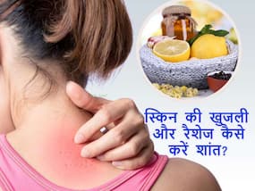सर्दियों में स्किन खुजला-खुजलाकर होने लगे हैं रैशेज? इन नुस्खों से करें तुरंत इसका इलाज
