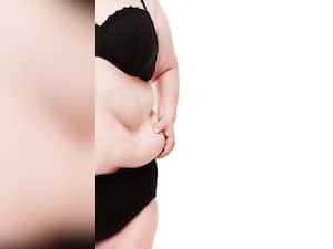 8 Practical Strategies to Tackle Obesity