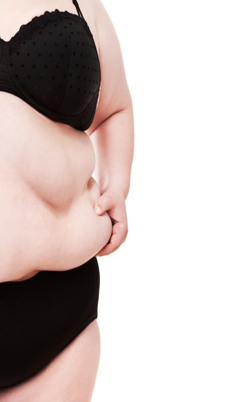 8 Practical Strategies to Tackle Obesity