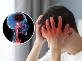 How To Save a Stroke Victim from Dying: Understanding The BEFAST Rule To Manage Signs of a Sudden Stroke Immediately
