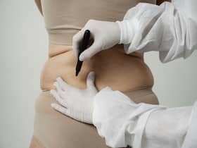 Body Positivity Or Trend? Exploring The Factors Behind The Rise Of This Cosmetic Surgery