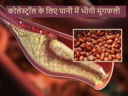 हाई कोलेस्ट्रॉल से परेशान मरीज रोज पानी में भिगो-भिगोकर खाएं मूंगफली, सर्दियों में भी धमनियां रहेंगी साफ