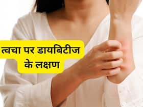 स्किन पर नजर आ रहे हैं ये 10 लक्षण तो आप हो सकते हैं डायबिटीज का शिकार