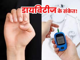 डायबिटीज की शुरुआत होने पर ऐसा हो जाता है नाखून का रंग, नाखूनों देखकर पहचानें आपको किस बीमारी का है खतरा