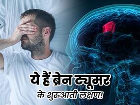 नींद में कमी से लेकर आंखों में धुंधलापन है ब्रेन ट्यूमर के शुरुआती लक्षण, समय रहते कराएं अपना चेकअप
