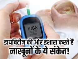 नाखूनों पर दिखने वाले इन 5 संकेतों से समझ जाएं ब्लड में बढ़ चुका है शुगर, समय पर हो जाएं सतर्क