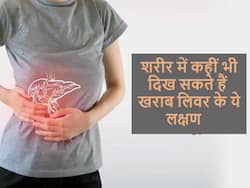 सिर से लेकर पैरों तक खराब लिवर के ये 5 लक्षण कहीं भी महसूस हो सकते हैं, अक्सर लोग कर देते हैं इग्नोर