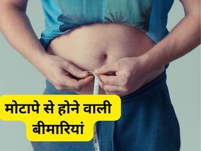 मोटापा अपने साथ लाता है ये 5 गंभीर बीमारियां, जानिए कौन सी बीमारी है जानलेवा!