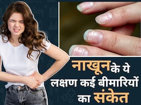 नाखूनों में दिखने वाले ये लक्षण लिवर डैमेज समेत इन 5 बड़ी बीमारियों का हो सकते हैं संकेत, इग्नोर करना बेवकूफी