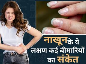 नाखूनों में दिखने वाले ये लक्षण लिवर डैमेज समेत इन 5 बड़ी बीमारियों का हो सकते हैं संकेत, इग्नोर करना बेवकूफी