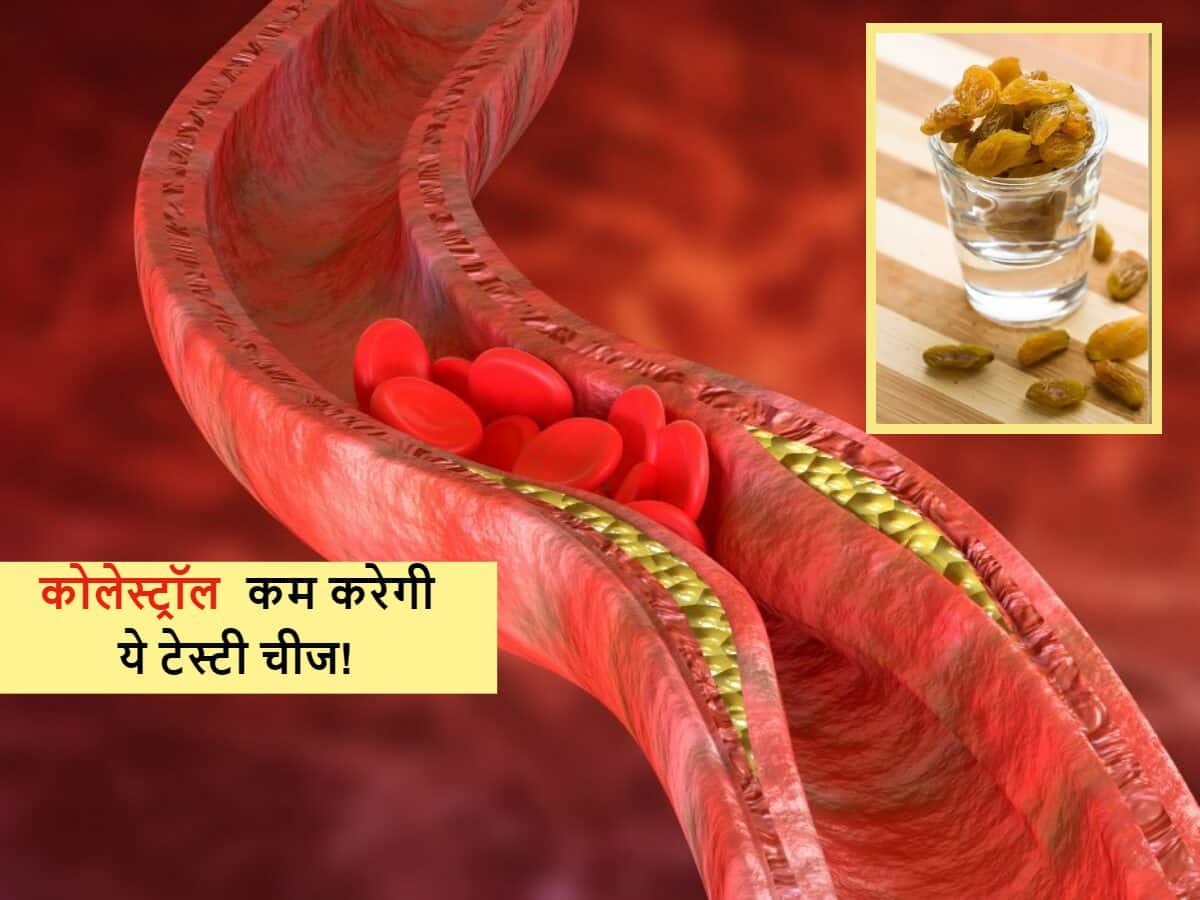 धमनियों में चिपका Bad cholesterol खींचकर निकाल देगी खट्टेमीठे स्वाद