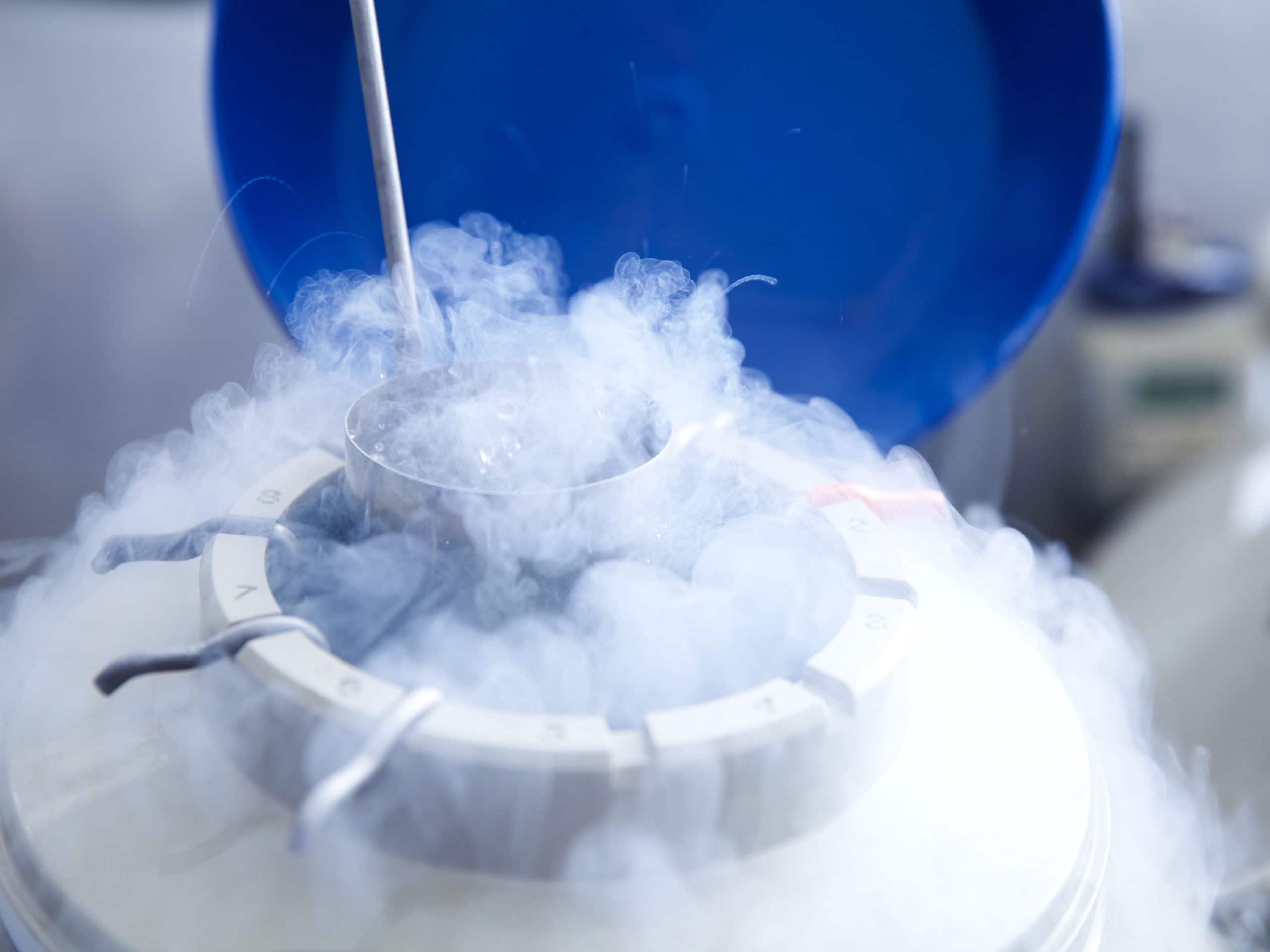Unmarried And Planning To Become A Father Later? Know All About Sperm Freezing - Vimarsana News