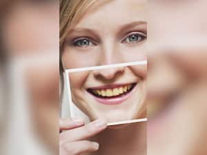 इस विटामिन की कमी के कारण पीले हो जाते हैं दांत