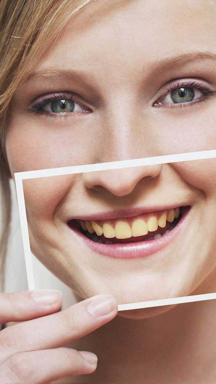 рдЗрд╕ рд╡рд┐рдЯрд╛рдорд┐рди рдХреА рдХрдореА рдХреЗ рдХрд╛рд░рдг рдкреАрд▓реЗ рд╣реЛ рдЬрд╛рддреЗ рд╣реИрдВ рджрд╛рдВрдд