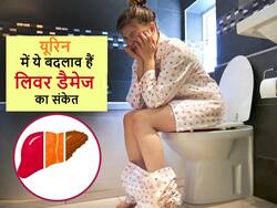 पानी कम पीने के कारण नहीं बल्कि लिवर खराब होने पर भी पेशाब में आ सकते हैं ये 5 बदलाव, डॉक्टर से जानें सच्चाई