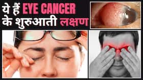 World Cancer Day 2024: इन लक्षणों को ना करें Ignore! हो सकते है Eye Cancer World Cancer Day 2024: इन लक्षणों को ना करें Ignore! हो सकते है Eye Cancer