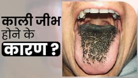 Black Tongue Causes: इन कारणों से जीभ होने लगती है काली, जानिए बचाव के उपाय