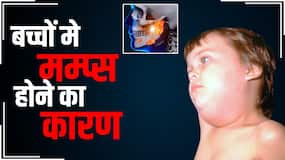 Mumps In Children Prevention Tips: बच्चों में मम्प्स की समस्या का ये है कारण? जानें बचाव का तरीका Mumps In Children Prevention Tips: बच्चों में मम्प्स की समस्या का ये है कारण? जानें बचाव का तरीका