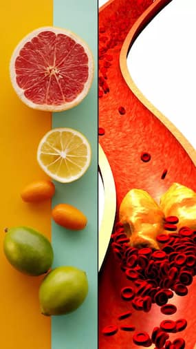 10 Cholesterol-Lowering Foods to Add to Your Diet Today