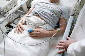 Is Chemotherapy Mandatory After Surgery For Colon Cancer?