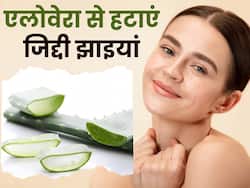 चेहरे की झाइयों से छुटकारा दिला सकता है एलोवेरा, इन 3 तरीकों से करें इस्तेमाल