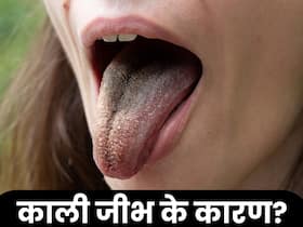 इन कारणों से जीभ होने लगता है काला, जानिए इसके लक्षण और बचाव के उपाय