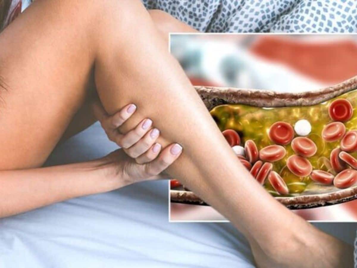 Cholesterol Control Tips: Top 7 Ways To Manage High Cholesterol Levels Without Medication - Vimarsana News