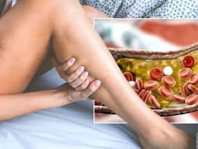 Cholesterol Control Tips: Top 7 Ways To Manage High Cholesterol Levels Without Medication