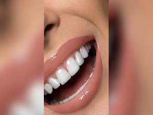 Remarkable Benefits of Coconut Oil for Teeth