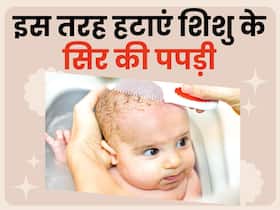 शिशु के सिर पर पपड़ी जमना हो सकता है क्रैडल कैप का संकेत, जानें इसे हटाने में घरेलू उपाय