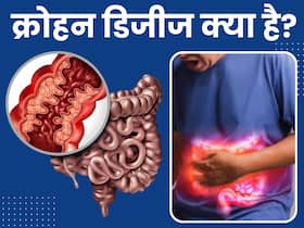 पेट में दर्द और दस्त हो सकता है क्रोहन डिजीज का संकेत, जानें इस बीमारी के लक्षण, कारण और इलाज