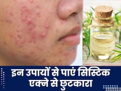 किन कारणों से चेहरे पर होते हैं सिस्टिक एक्ने? जानें इनसे छुटकारा पाने के उपाय