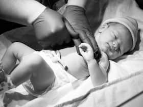 How A 2-Month-Old Baby With High Carbon Dioxide In Body Was Saved By Doctors