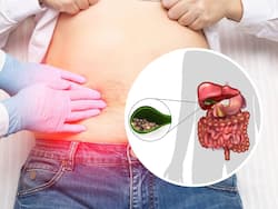 Pain in Upper Abdomen Could Indicate Gallstones: 5 Unusual Signs That May Show Up When Your Gallbladder Is At Risk