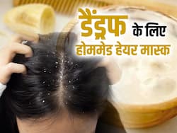 सर्दियों में नैचुरल तरीके से पाएं रूसी से छुटकारा, आजमाएं ये 3 होममेड एंटी-डैंड्रफ हेयर मास्क
