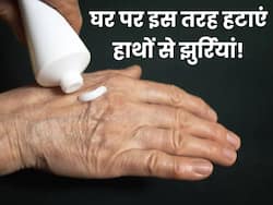 सर्दियों में हाथों पर पड़ने लगी हैं झुर्रियां, इन 5 नुस्खों से मिनटों में मिलेगा Wrinkles से छुटकारा