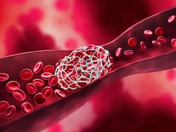 Heart Health: Top 7 Natural Blood Thinners That May Help Prevent Stroke