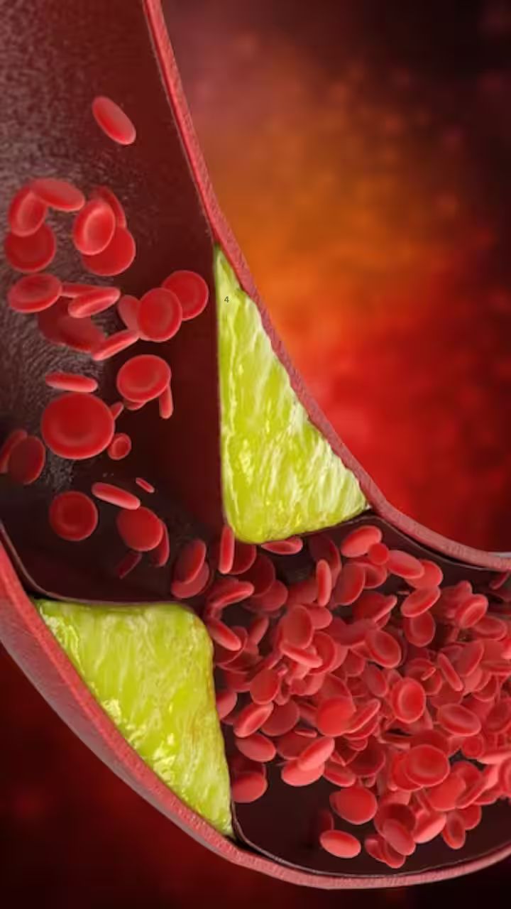 Heart Health: Top 8 Natural Blood Thinners That Can Prevent Stroke