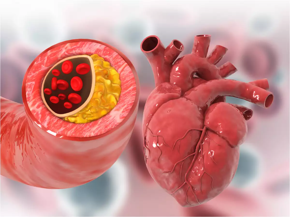 Santé cardiaque : 7 meilleurs conseils diététiques pour déboucher vos artères naturellement et prévenir les accidents vasculaires cérébraux